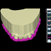 s digitalización (intraoral y/o modelos)